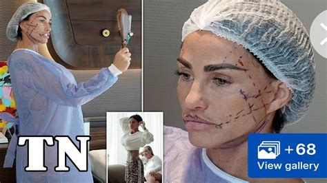 Katie Prices £10,000 facelift surprises fans in a new video